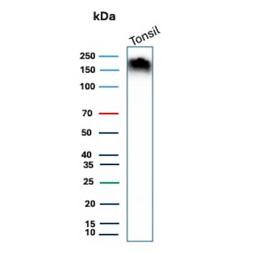 Western Blot Analysis of Human Tonsil tissue lysate using CD45RA Antibody (PTPRC/8699R).