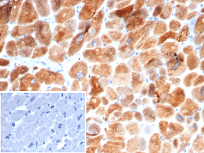 Formalin-fixed, paraffin-embedded human heart stained with AlphaB Crystallin/CRYAB antibody (CRYAB/4663). Inset: PBS instead of primary antibody; secondary only negative control.