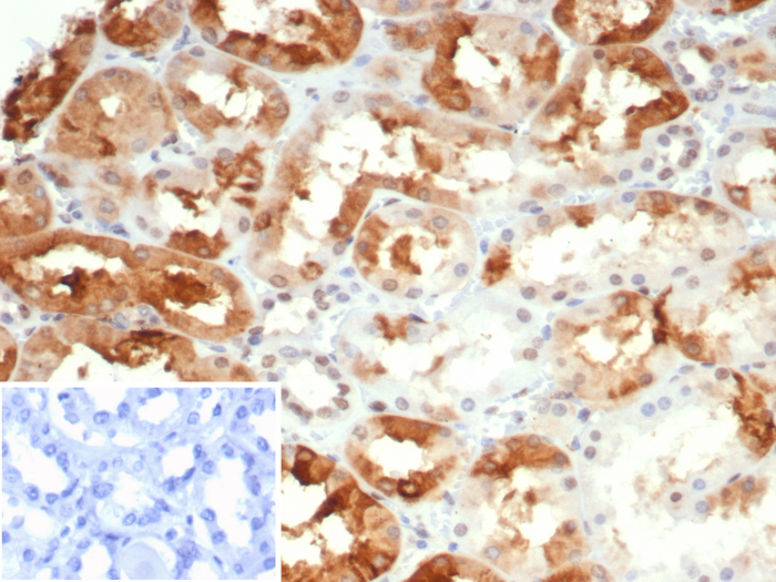 Formalin-fixed, paraffin-embedded human kidney stained with AlphaB Crystallin/CRYAB antibody (CRYAB/4665). Inset: PBS instead of primary antibody; secondary only negative control.