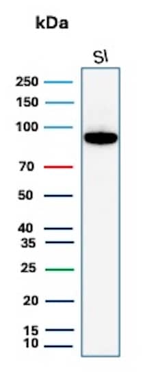 Western Blot Analysis of human small intestine tissue lysate using Cadherin-17 Antibody (rCDH17/8512). 