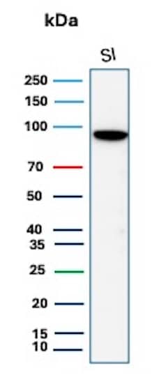 Western Blot Analysis of  human small intestine tissue lysate using Cadherin-17 Antibody (rCDH17/8514). 