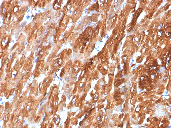 Formalin-fixed, paraffin-embedded human heart stained with AlphaB Crystallin/CRYAB antibody (CRYAB/7918). HIER: Tris/EDTA, pH9.0, 45min. Secondary: HRP-polymer, 30min. DAB, 5min.