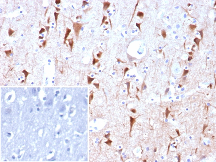 Formalin-fixed, paraffin-embedded human brain stained with NECAB1 antibody (NECAB1/7680). Inset: PBS instead of primary antibody; secondary only negative control.