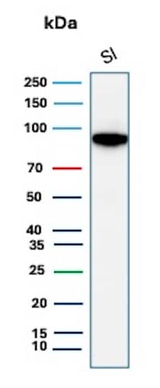 Western Blot Analysis of human Small Intestine tissue lysate using Cadherin-17 Antibody (CDH17/8513R).