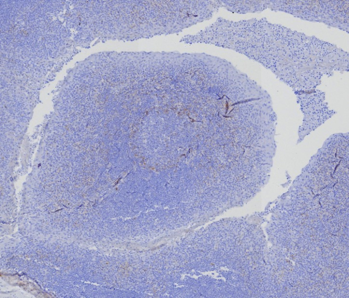 Formalin-fixed, paraffin-embedded human tonsil stained with BCMA/TNFRSF17 antibody (CD269/8276R). HIER: Tris/EDTA, pH9.0, 45min. Secondary: HRP-polymer, 30min. DAB, 5min.