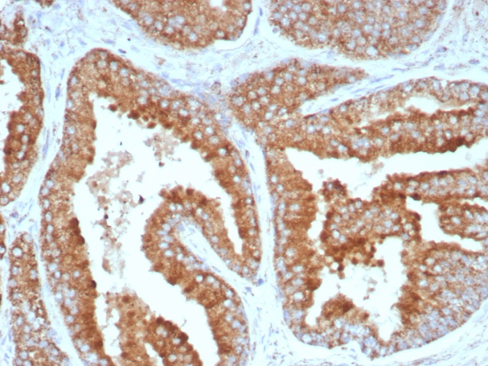 Formalin-fixed, paraffin-embedded human prostate stained with BCMA/TNFRSF17 antibody (CD269/8508R). HIER: Tris/EDTA, pH9.0, 45min. Secondary: HRP-polymer, 30min. DAB, 5min.