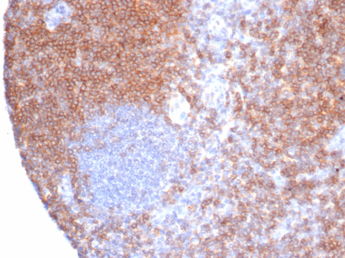 Formalin-fixed, paraffin-embedded human tonsil stained with CD6 antibody (rC6/372). HIER: Tris/EDTA, pH9.0, 45min. Secondary: HRP-polymer, 30min. DAB, 5min.