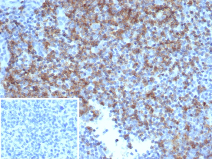 Formalin-fixed, paraffin-embedded human tonsil stained with CD6 antibody (rC6/372). Inset: PBS instead of primary antibody; secondary only negative control.