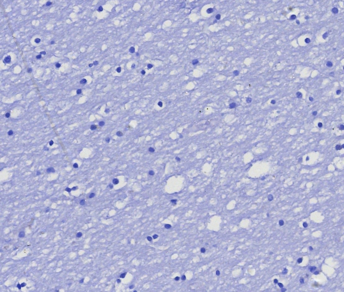 IHC analysis of formalin-fixed, paraffin-embedded human brain. Negative tissue control using MGMT antibody (MGMT/8364R) at 2ug/ml in PBS for 30min RT. HIER: Tris/EDTA, pH9.0, 45min. Secondary: HRP-polymer, 30min. DAB, 5min.