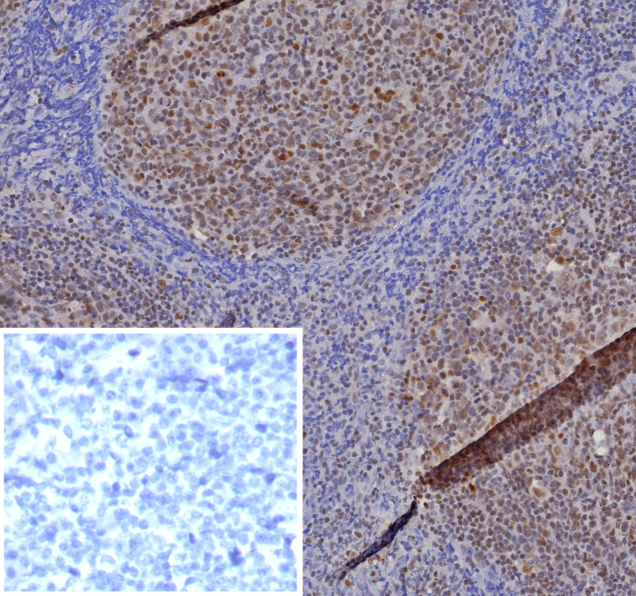 Formalin-fixed, paraffin-embedded human tonsil stained with MGMT antibody (MGMT/8364R). HIER: Tris/EDTA, pH9.0, 45min. Secondary: HRP-polymer, 30min. DAB, 5min.