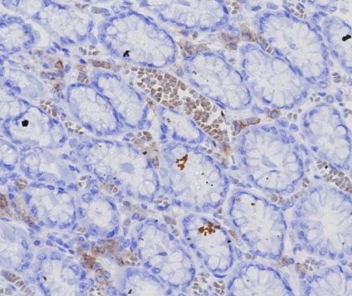 Formalin-fixed, paraffin-embedded human stomach, corpus stained with BCMA/TNFRSF17 antibody (CD269/7986R). HIER: Tris/EDTA, pH9.0, 45min. Secondary: HRP-polymer, 30min. DAB, 5min.