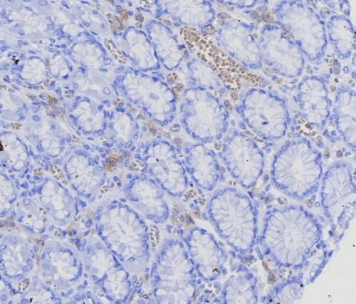 Formalin-fixed, paraffin-embedded human stomach, corpus stained with BCMA/TNFRSF17 antibody (CD269/8125R). HIER: Tris/EDTA, pH9.0, 45min. Secondary: HRP-polymer, 30min. DAB, 5min.