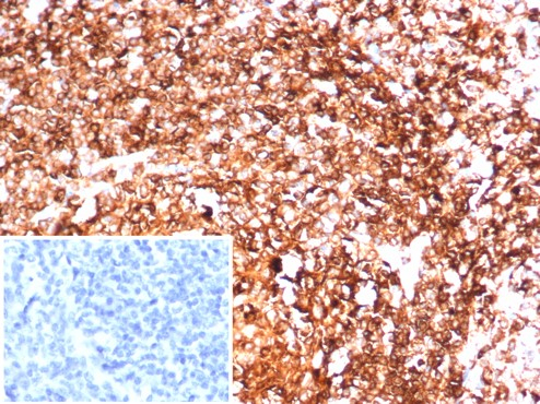 Formalin-fixed, paraffin-embedded human tonsil stained with HLA-DR antibody (HLA-DRA/6844R). Inset: PBS instead of primary antibody; secondary only negative control