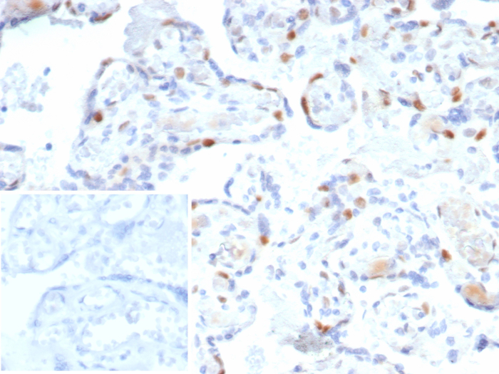 IHC analysis of formalin-fixed, paraffin-embedded human bladder. Strong nuclear staining using p57 Kip2 antibody (rKIP2/7238) at 2ug/ml in PBS for 30min RT. Inset: PBS instead of primary antibody; secondary only negative control.