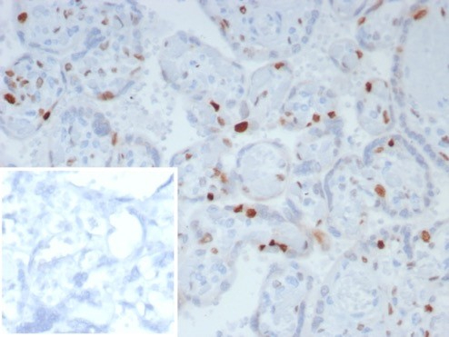 IHC analysis of formalin-fixed, paraffin-embedded human placenta. Strong nuclear staining using p57 Kip2 antibody (KIP2/8169R) at 2ug/ml in PBS for 30min RT. Inset: PBS instead of primary antibody; secondary only negative control.
