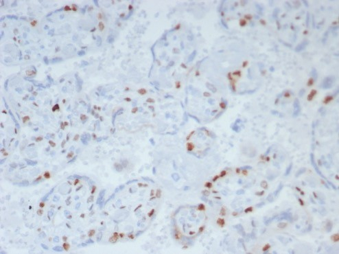 IHC analysis of formalin-fixed, paraffin-embedded human placenta. Strong nuclear staining using p57 Kip2 antibody (KIP2/8169R) at 2ug/ml in PBS for 30min RT. HIER: Tris/EDTA, pH9.0, 45min. Secondary: HRP-polymer, 30min. DAB, 5min.