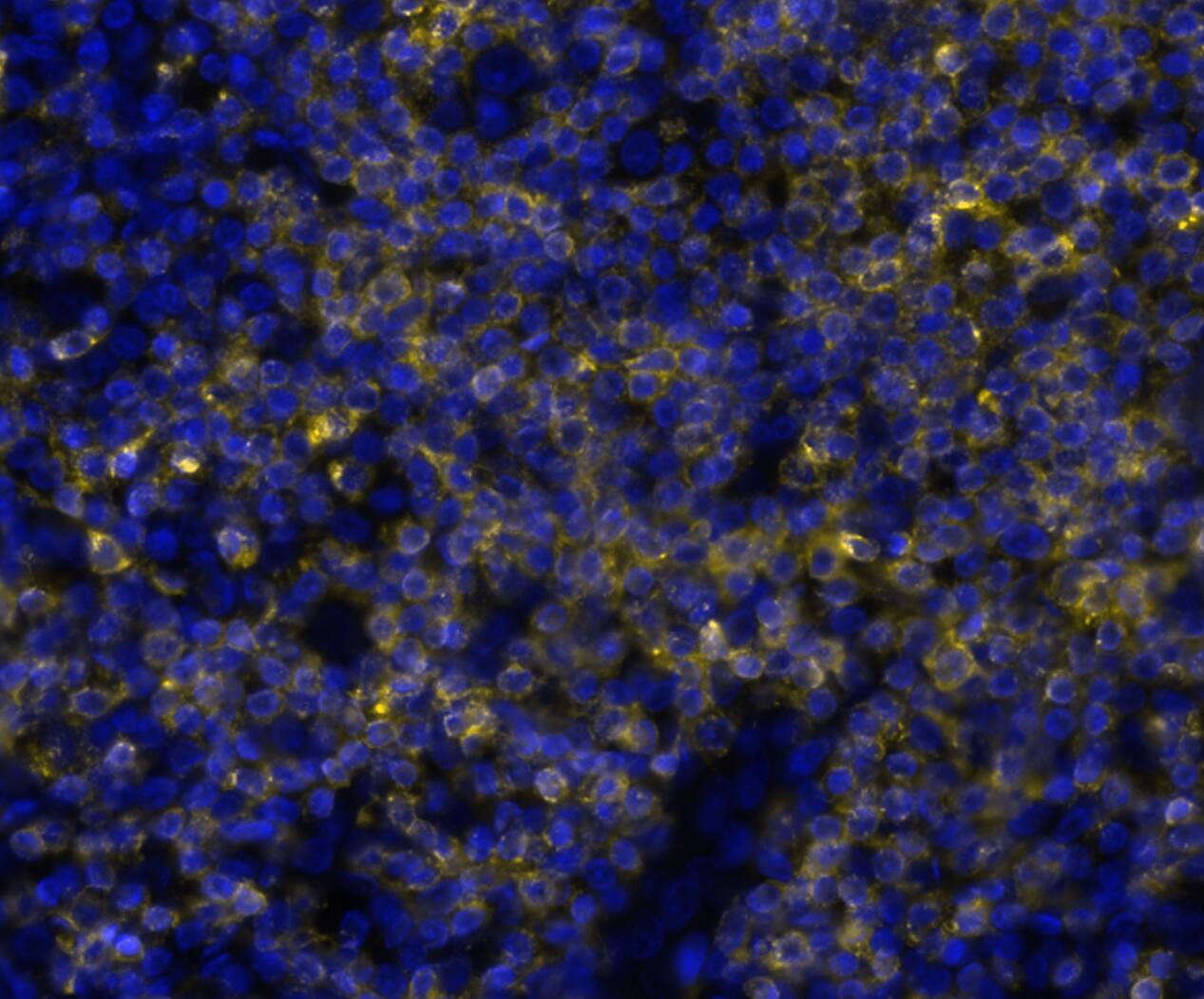 CD7 was detected in immersion fixed paraffin-embedded sections of human appendix using Mouse Anti-Human CD7, Monoclonal Antibody (Catalog # NBP3-20452) at 0.2ug/mL at 37 ° Celsius for 4 minutes. Before incubation with the primary antibody, tissue underwent an all-in-one dewaxing and antigen retrieval preprocessing using PreTreatment Module (PT Module)and Dewax and HIER Buffer H (pH 9; Epredia Catalog #TA-999-DHBH). Tissue was stained using the Alexa Fluor™ 647 Goat anti-Mouse IgG Secondary Antibody at 1:200 at 37 ° Celsius for 2 minutes. (Yellow; Lunaphore Catalog # DR647MS) and counterstained with DAPI (blue; Lunaphore Catalog # DR100). Specific staining was localized to the membrane. Protocol available in COMET™ Panel Builder.