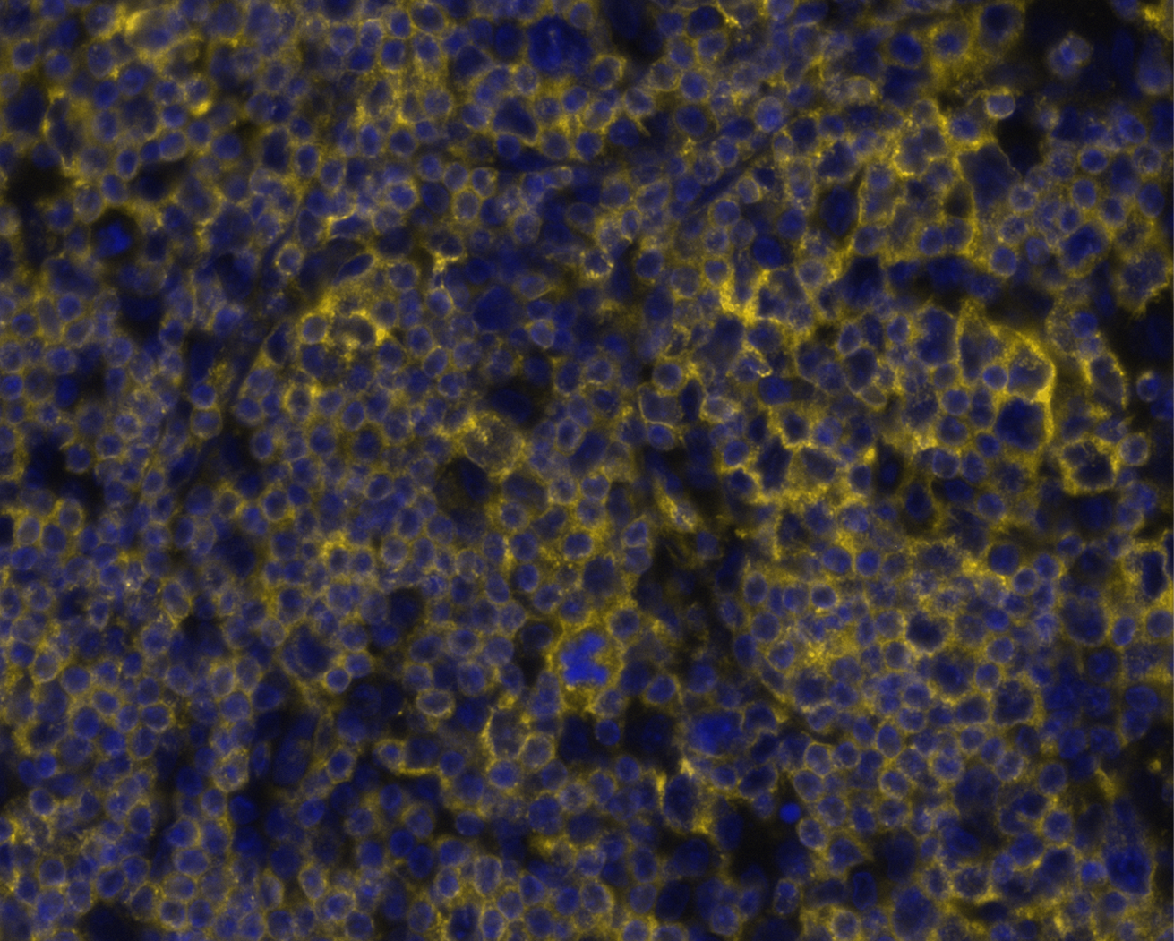 CD7 was detected in immersion fixed paraffin-embedded sections of human T-cell Acute Lymphoblastic Lymphoma using Mouse Anti-Human CD7, Monoclonal Antibody (Catalog # NBP3-20452) at 0.2ug/mL at 37 ° Celsius for 4 minutes. Before incubation with the primary antibody, tissue underwent an all-in-one dewaxing and antigen retrieval preprocessing using PreTreatment Module (PT Module) and Dewax and HIER Buffer H (pH 9; Epredia Catalog #TA-999-DHBH). Tissue was stained using the Alexa Fluor™ 647 Goat anti-Mouse IgG Secondary Antibody at 1:200 at 37 ° Celsius for 2 minutes. (Yellow; Lunaphore Catalog # DR647MS) and counterstained with DAPI (blue; Lunaphore Catalog # DR100). Specific staining was localized to the membrane. Protocol available in COMET™ Panel Builder.