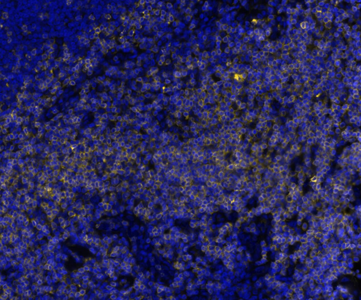 CD7 was detected in immersion fixed paraffin-embedded sections of human tonsil using Mouse Anti-Human CD7, Monoclonal Antibody (Catalog #NBP3-20452) at 0.2ug/mL at 37 ° Celsius for 4 minutes. Before incubation with the primary antibody, tissue underwent an all-in-one dewaxing and antigen retrieval preprocessing using PreTreatment Module (PT Module)and Dewax and HIER Buffer H (pH 9; Epredia Catalog #TA-999-DHBH). Tissue was stained using the Alexa Fluor™ 647 Goat anti-Mouse IgG Secondary Antibody at 1:200 at 37 ° Celsius for 2 minutes. (Yellow; Lunaphore Catalog # DR647MS) and counterstained with DAPI (blue; Lunaphore Catalog # DR100). Specific staining was localized to the membrane. Protocol available in COMET™ Panel Builder.​
