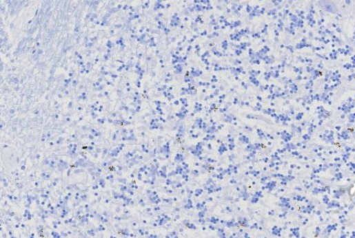IHC analysis of formalin-fixed, paraffin-embedded human brain. Negative tissue control using MGMT antibody (MGMT/8128R) at 2ug/ml in PBS for 30min RT. HIER: Tris/EDTA, pH9.0, 45min. Secondary: HRP-polymer, 30min. DAB, 5min.