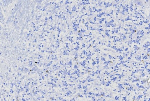 IHC analysis of formalin-fixed, paraffin-embedded human brain. Negative tissue control using MGMT antibody (MGMT/8128R) at 2ug/ml in PBS for 30min RT. HIER: Tris/EDTA, pH9.0, 45min. Secondary: HRP-polymer, 30min. DAB, 5min.