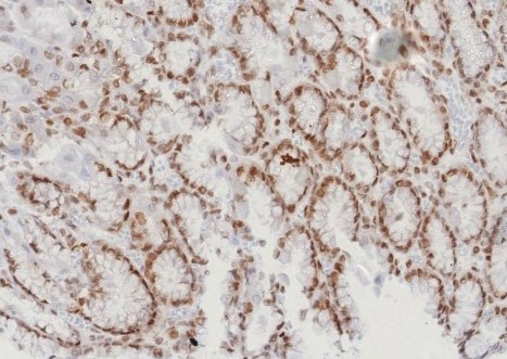 Formalin-fixed, paraffin-embedded human stomach (corpus) stained with MGMT antibody (MGMT/8128R). HIER: Tris/EDTA, pH9.0, 45min. Secondary: HRP-polymer, 30min. DAB, 5min.