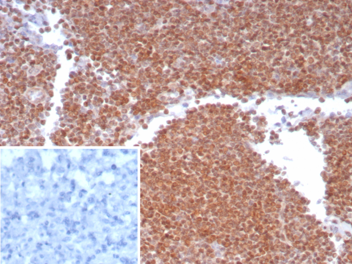 Formalin-fixed, paraffin-embedded human lymph node stained with MGMT antibody (MGMT/8186R). HIER: Tris/EDTA, pH9.0, 45min. Secondary: HRP-polymer, 30min. DAB, 5min.