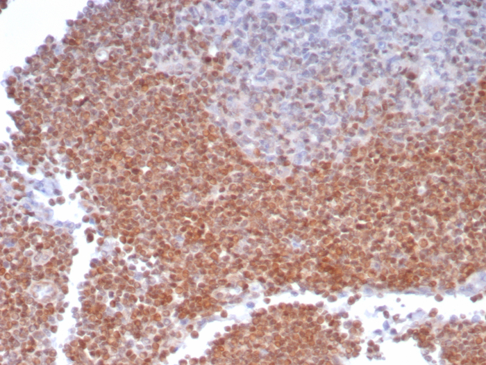 Formalin-fixed, paraffin-embedded human lymph node stained with MGMT antibody (MGMT/8186R). HIER: Tris/EDTA, pH9.0, 45min. Secondary: HRP-polymer, 30min. DAB, 5min.