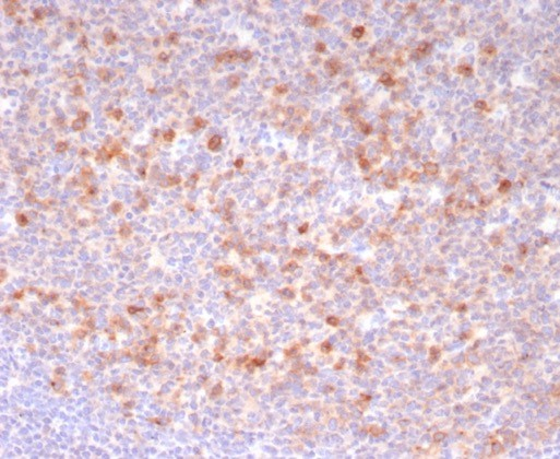 Formalin-fixed, paraffin-embedded human tonsil stained with BCMA/TNFRSF17 antibody (CD269/8190R). HIER: Tris/EDTA, pH9.0, 45min. Secondary: HRP-polymer, 30min. DAB, 5min.