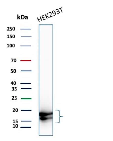 Western Blot Analysis of HEK293T cell lysate using p16INK4a/CDKN2A Antibody (CDKN2A/8223R).