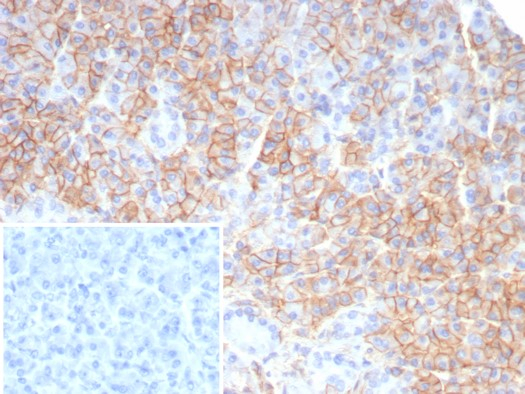 Formalin-fixed, paraffin-embedded human pancreas stained with CD99 antibody (rMIC2/6939). Inset: PBS instead of primary antibody; secondary only negative control.