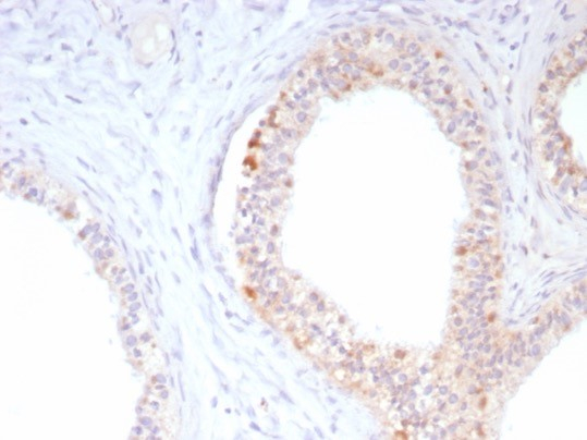 Formalin-fixed, paraffin-embedded human epididymis stained with ROS antibody (ROS1/8216R). HIER: Tris/EDTA, pH9.0, 45min. Secondary: HRP-polymer, 30min. DAB, 5min.