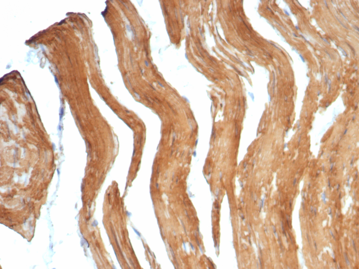 Formalin-fixed, paraffin-embedded human smooth muscle stained with Myosin heavy chain 11 antibody (MYH11/7610R). HIER: Tris/EDTA, pH9.0, 45min. Secondary: HRP-polymer, 30min. DAB, 5min.