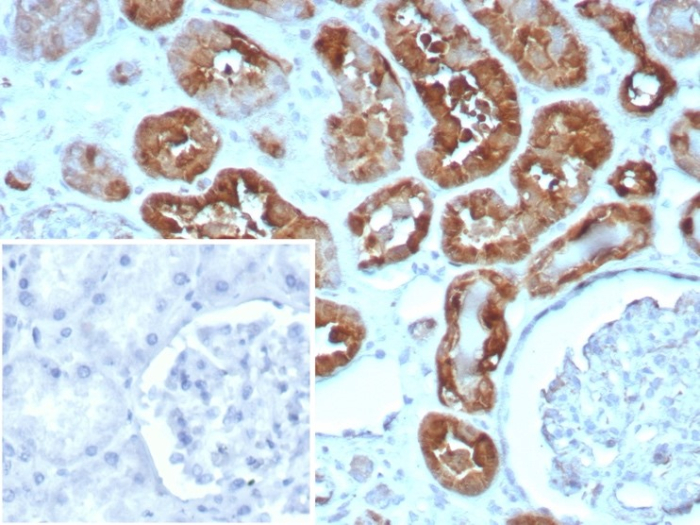 Formalin-fixed, paraffin-embedded human heart stained with FABP3/H-FABP antibody (rFABP3/8534). HIER: Tris/EDTA, pH9.0, 45min. Secondary: HRP-polymer, 30min. DAB, 5min.