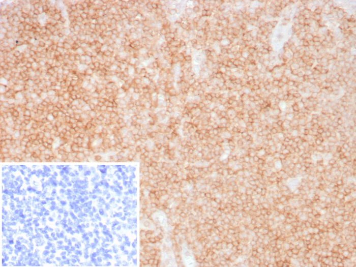 Formalin-fixed, paraffin-embedded human tonsil stained with CD48/SLAMF2 antibody (CD48/8360R). Inset: PBS instead of primary antibody; secondary only negative control.