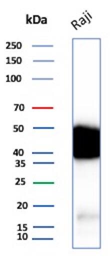 Western blot analysis of Raji cell lysate using CD48/SLAMF2 Antibody (CD48/8360R).