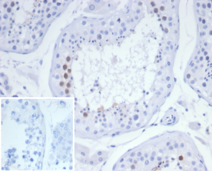 Formalin-fixed, paraffin-embedded human testis stained with KIF2C antibody (KIF2C/6525) at 2ug/ml. Inset: PBS instead of primary antibody; secondary only negative control.