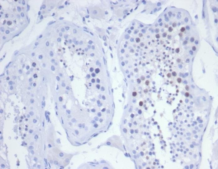 Formalin-fixed, paraffin-embedded human testis stained with KIF2C antibody (KIF2C/6525) at 2ug/ml. HIER: Tris/EDTA, pH9.0, 45min. Secondary: HRP-polymer, 30min. DAB, 5min.