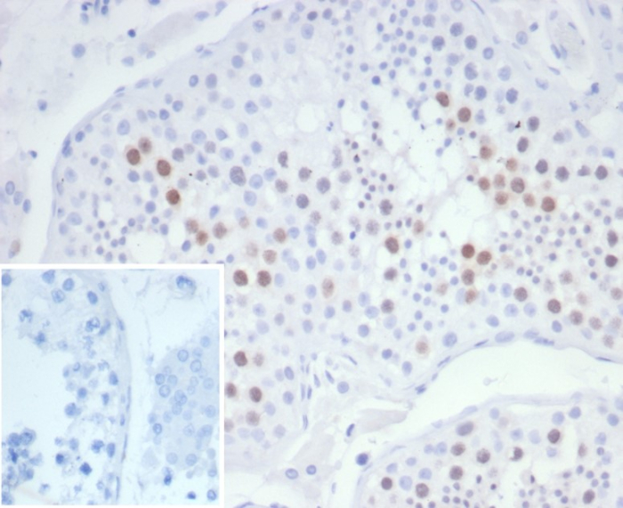 Formalin-fixed, paraffin-embedded human testis stained with KIF2C antibody (KIF2C/6526) at 2ug/ml. Inset: PBS instead of primary antibody; secondary only negative control.