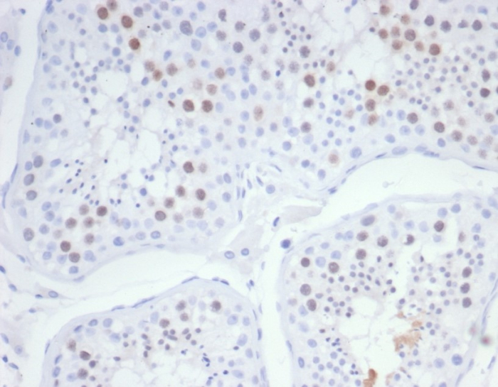 Formalin-fixed, paraffin-embedded human testis stained with KIF2C antibody (KIF2C/6526) at 2ug/ml. HIER: Tris/EDTA, pH9.0, 45min. Secondary: HRP-polymer, 30min. DAB, 5min.