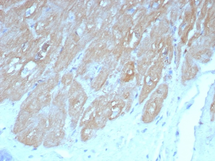 Formalin-fixed, paraffin-embedded human heart stained with FABP3/H-FABP antibody (FABP3/8440). HIER: Tris/EDTA, pH9.0, 45min. Secondary: HRP-polymer, 30min. DAB, 5min.