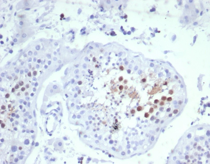 Formalin-fixed, paraffin-embedded human testis stained with KIF2C antibody (KIF2C/6529) at 2ug/ml. HIER: Tris/EDTA, pH9.0, 45min. Secondary: HRP-polymer, 30min. DAB, 5min.