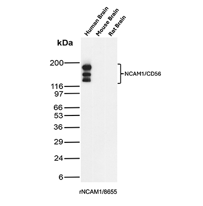 Western blot analysis of  Human Brain, Mouse Brain and Rat Brain tissue lysates using NCAM-1/CD56 Antibody (rNCAM1/8655).