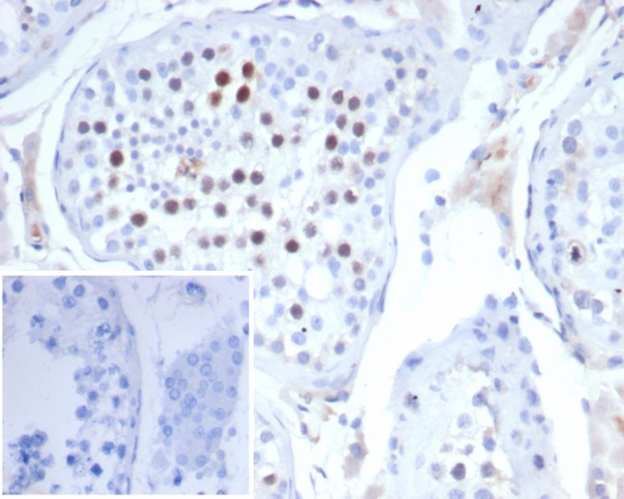 Formalin-fixed, paraffin-embedded human testis stained with KIF2C antibody (KIF2C/4702). Inset: PBS instead of primary antibody; secondary only negative control.