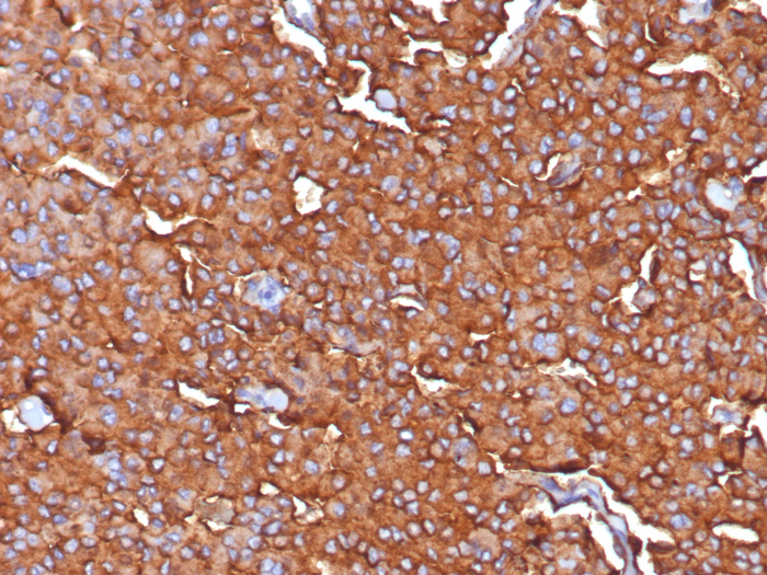 Formalin-fixed, paraffin-embedded human adrenal stained with Synaptophysin antibody (SYP/7976R). HIER: Tris/EDTA, pH9.0, 45min. Secondary: HRP-polymer, 30min. DAB, 5min.