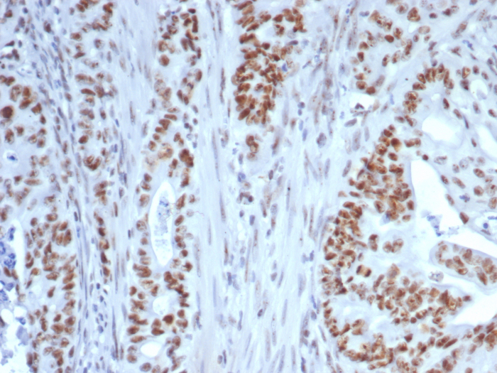 Formalin-fixed, paraffin-embedded human colon stained with Nucleolin antibody (NCL/7339). HIER: Tris/EDTA, pH9.0, 45min. Secondary: HRP-polymer, 30min. DAB, 5min.