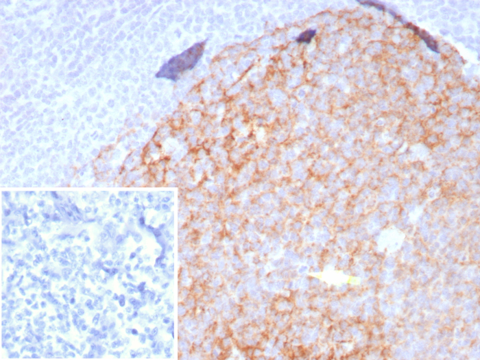 Formalin-fixed, paraffin-embedded human tonsil stained with CD23/Fc epsilon RII antibody (FCER2/8509R). Inset: PBS instead of primary antibody; secondary only negative control.