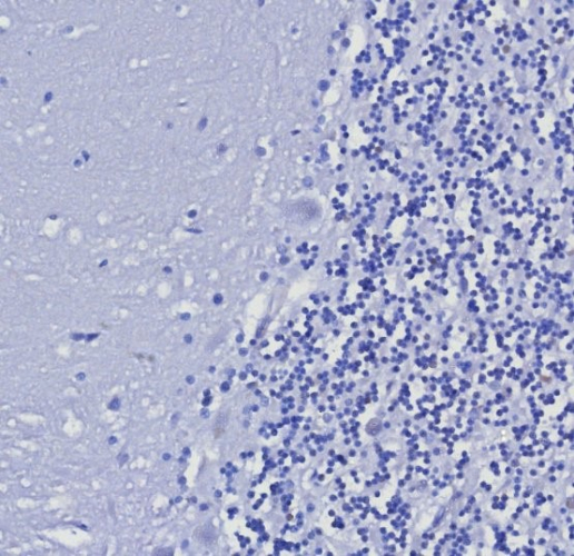 IHC analysis of formalin-fixed, paraffin-embedded human brain. Negative tissue control using Cytokeratin 5/6 antibody (KRT5.6/8275R) at 2ug/ml in PBS for 30min RT. HIER: Tris/EDTA, pH9.0, 45min. Secondary: HRP-polymer, 30min. DAB, 5min.