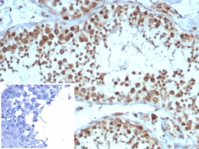 Formalin-fixed, paraffin-embedded human testis stained with KIF2C Antibody (KIF2C/4705) at 2ug/ml. Inset: PBS instead of primary antibody; secondary only negative control.