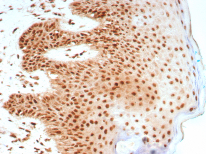 Formalin-fixed, paraffin-embedded human skin stained with Nucleolin antibody (NCL/8695R). HIER: Tris/EDTA, pH9.0, 45min. Secondary: HRP-polymer, 30min. DAB, 5min.